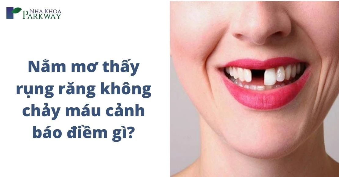 Nằm Mơ Thấy Gãy Răng Tìm Hiểu Về Giấc Mơ Này